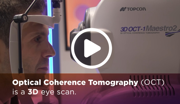 OCT 3d Eye Scan